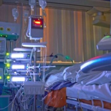 Paciente crítico adulto